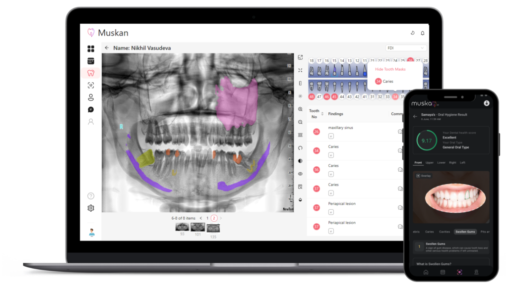 Muskan.ai | AI powered Dentistry | Home Page
